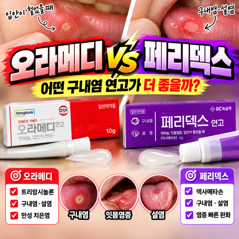 오라메디 페리덱스 차이, 구내염에는 어떤 연고가 더 효과적일까?