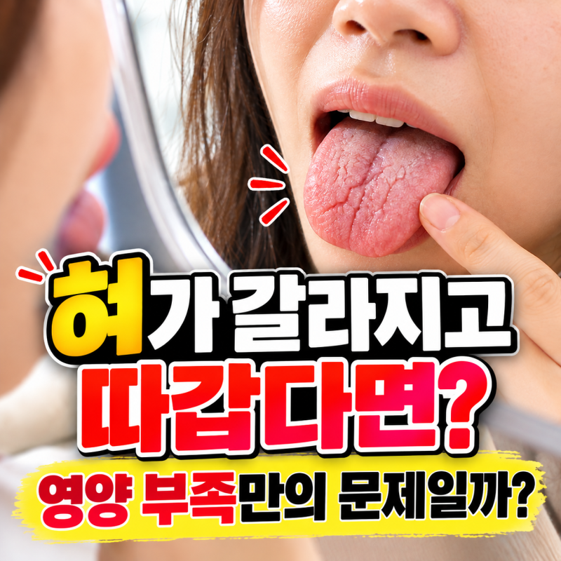 혀가 자꾸 갈라지고 따갑다면? 영양 부족인 줄 알았는데 확인해야 할 원인 6가지