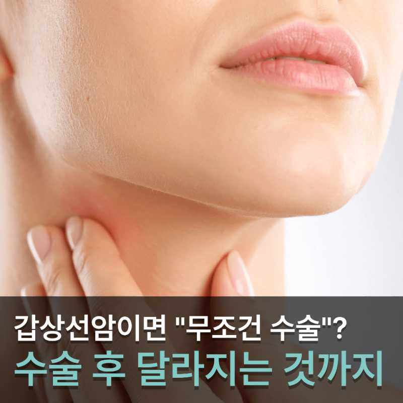 갑상선암 진단받으면 무조건 수술할까? 후유증까지 알아둘 4가지