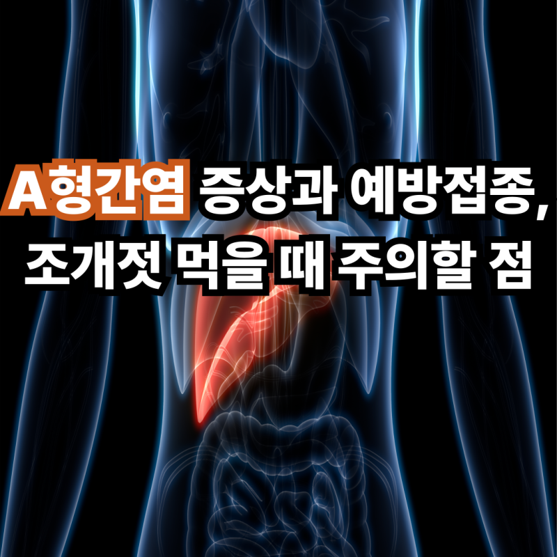 A형간염 증상과 예방접종, 조개젓 먹을 때 주의할 점