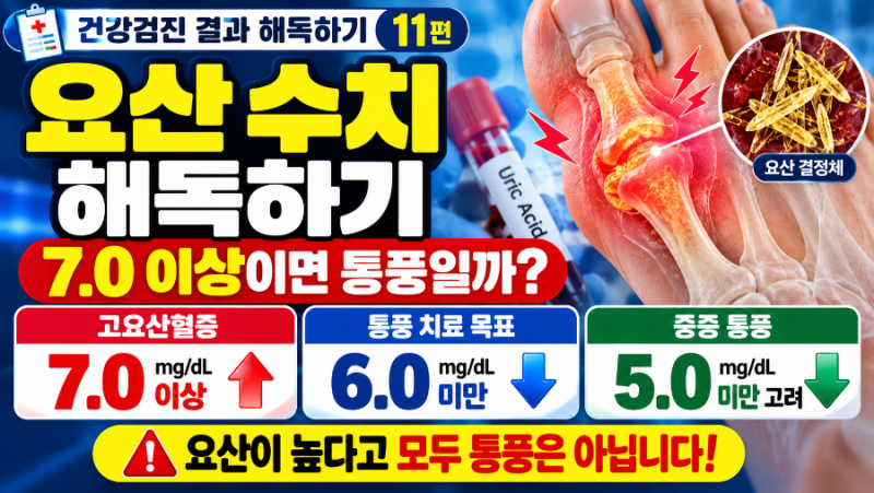 [건강검진 결과 해독하기 11편] 요산 수치 - 요산 7.0 이상이면 통풍일까?