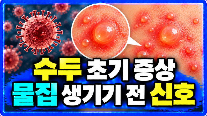 수두 초기증상과 예방접종 시기 물집 생기기 전 확인할 점