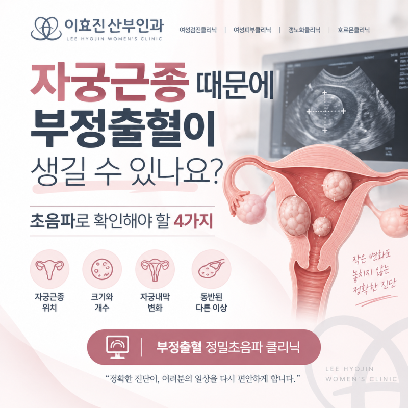 서초구 산부인과 자궁근종 때문에 부정출혈이 생길 수 있나요? 초음파로 확인해야 할 4가지