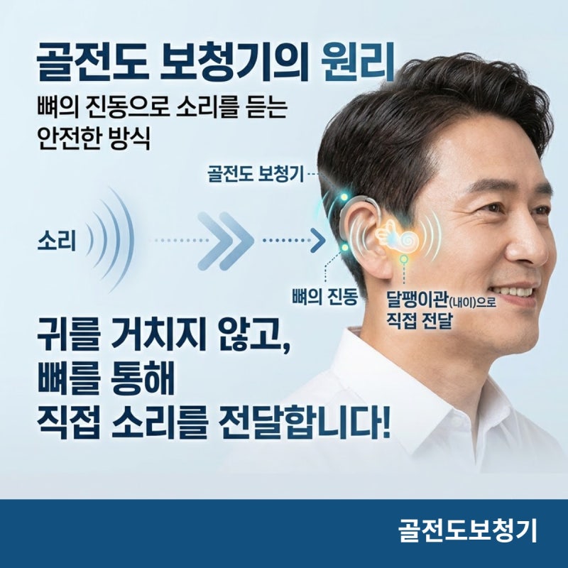 골전도보청기 '40dB'에서 '70dB'까지, 그 격차의 차이는..