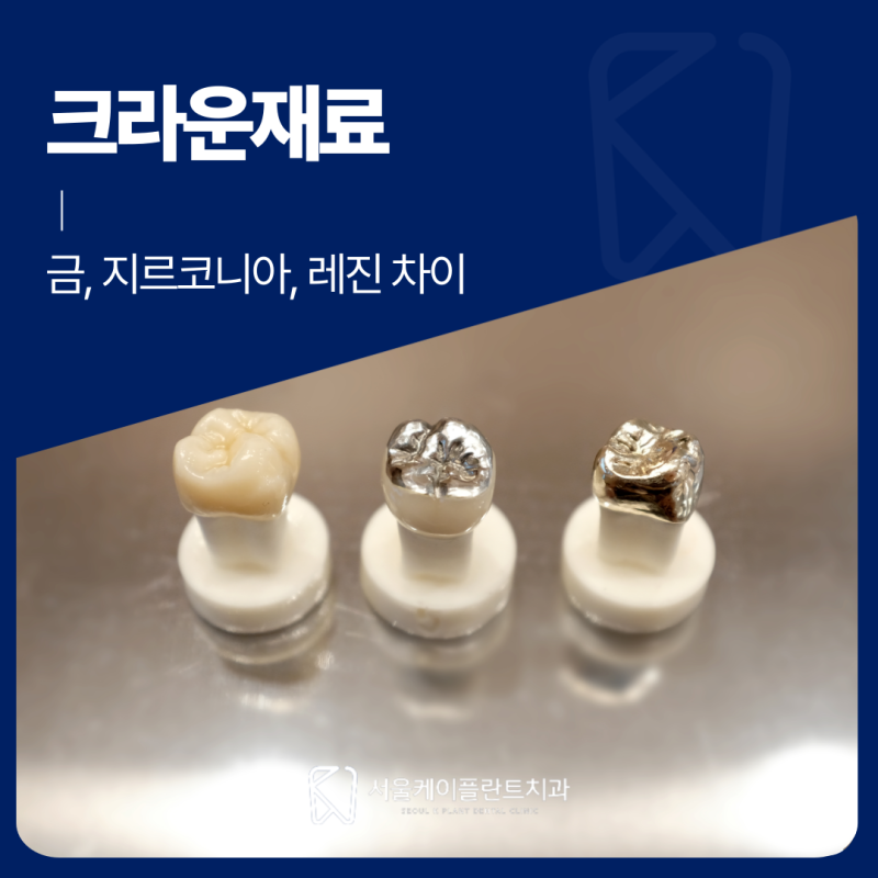 작전역치과 견적서의 크라운 재료 이름이 낯설다면 금, 지르코니아, 레진 차이부터 비교해보....