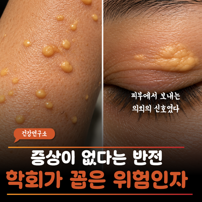 피부에 붉거나 노란 혹이 보인다면… 중성지방이 매우 높을 때 나타날 수 있는 고지혈증 증....