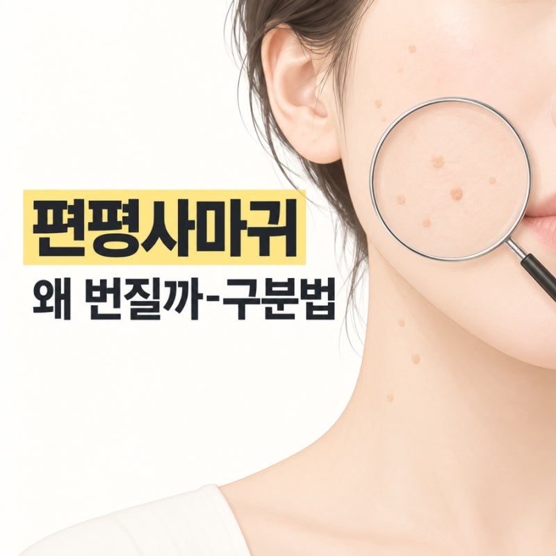 편평사마귀 원인과 번지는 이유, 비립종 쥐젖과 구분하는 법