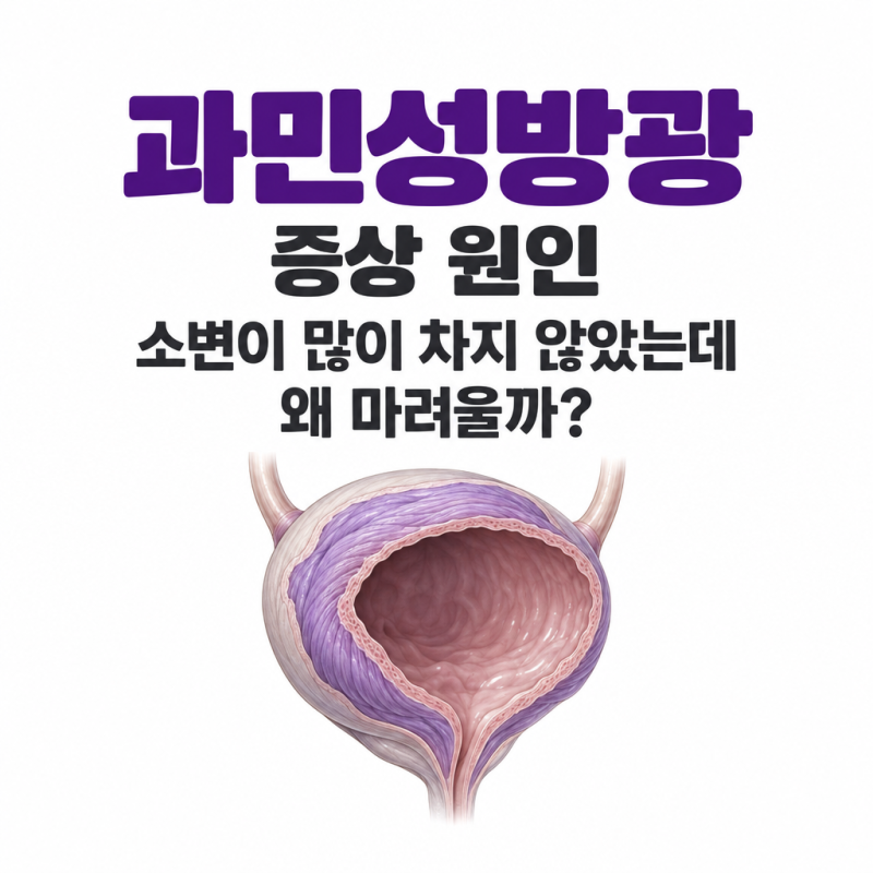 과민성방광 증상 원인, 소변이 많이 차지 않았는데 왜 마려울까?