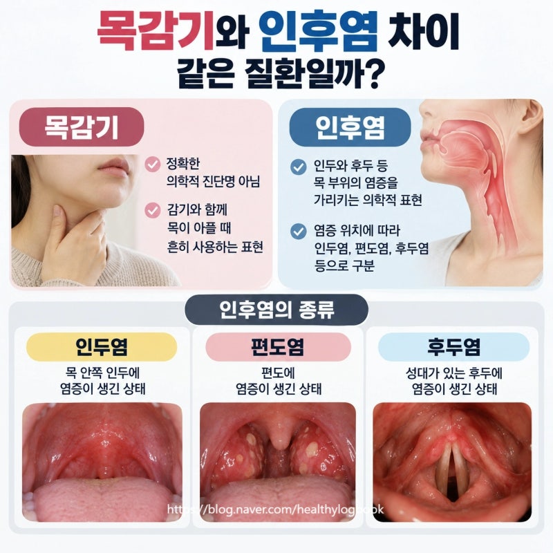 목이 칼칼하고 침 삼킬 때 아프다면? 환절기 목감기·인후염 구별법