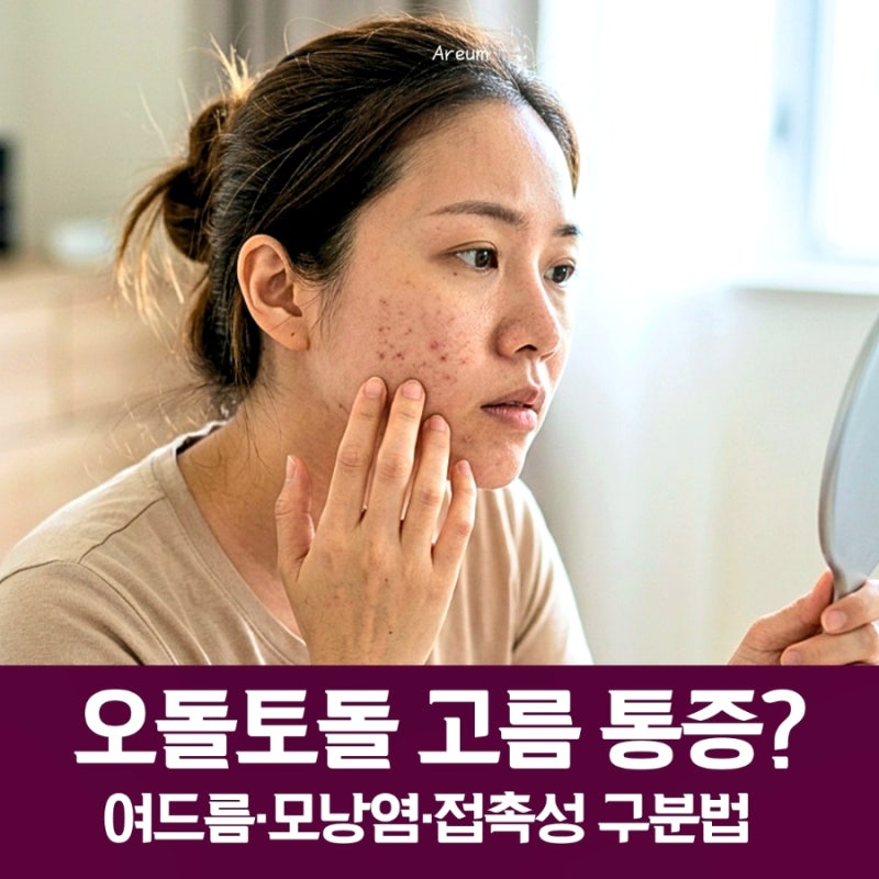 얼굴 오돌토돌 좁쌀 여드름·모낭염·접촉성 피부염: 고름·통증에 따른 애매한 구분법 딱 정....