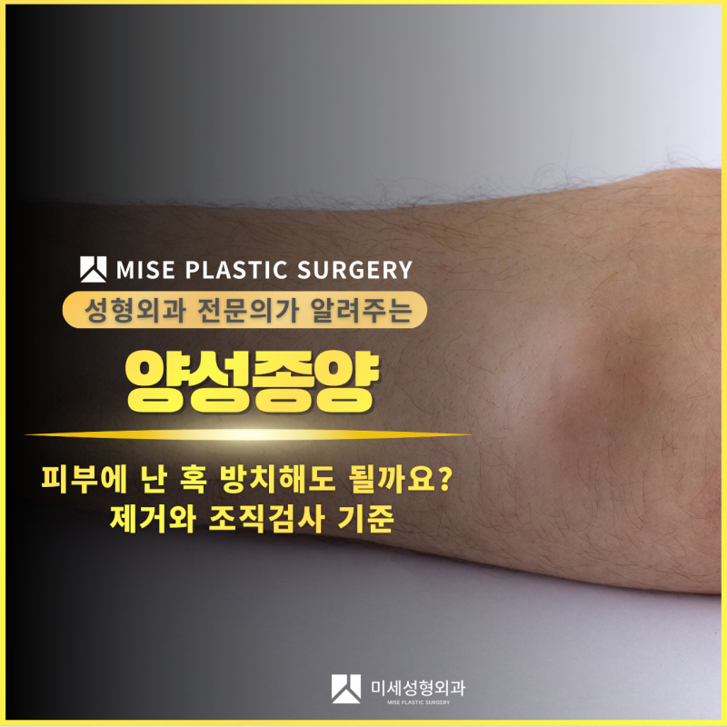 수원 광교 동탄 안산 수지 오산 평택 양성종양, 피부에 난 혹 방치해도 될까요? 제거와 조직....