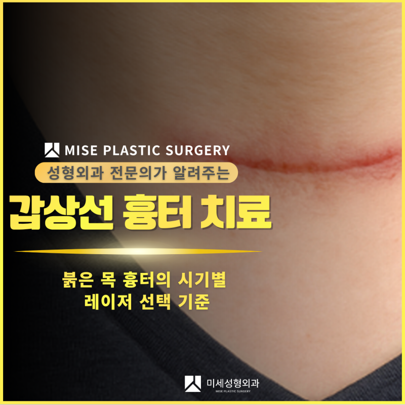 수원 광교 동탄 수지 오산 안산 갑상선 흉터 치료, 붉은 목 흉터의 시기별 레이저 선택 기준