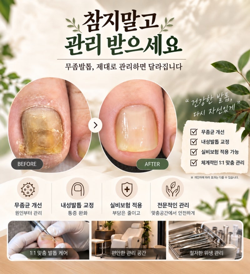 광주 무좀 내성 발톱 병원 수완지구 발톱 통증 검사부터 치료 상담 내돈내산 후기