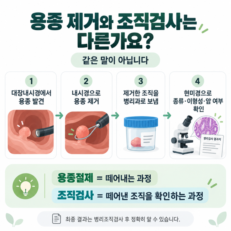 [부산 대장내시경] 용종 제거 후 선종이라고 합니다, 암인가요? 조직검사·제자리암·제거방....