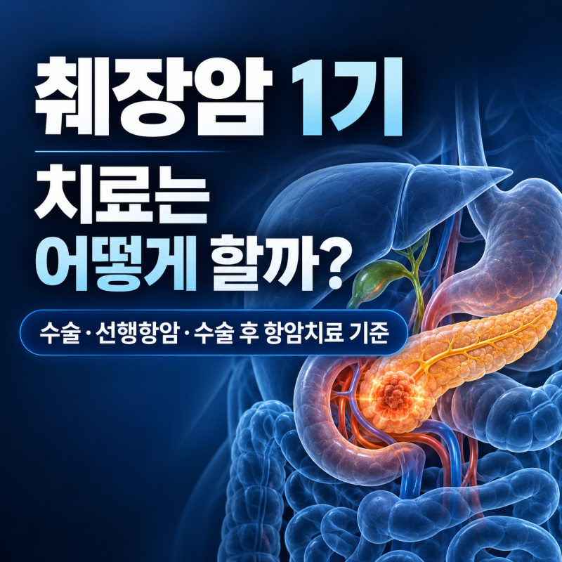 췌장암 1기 치료는 어떻게 할까? 수술·선행항암·수술 후 항암치료 기준