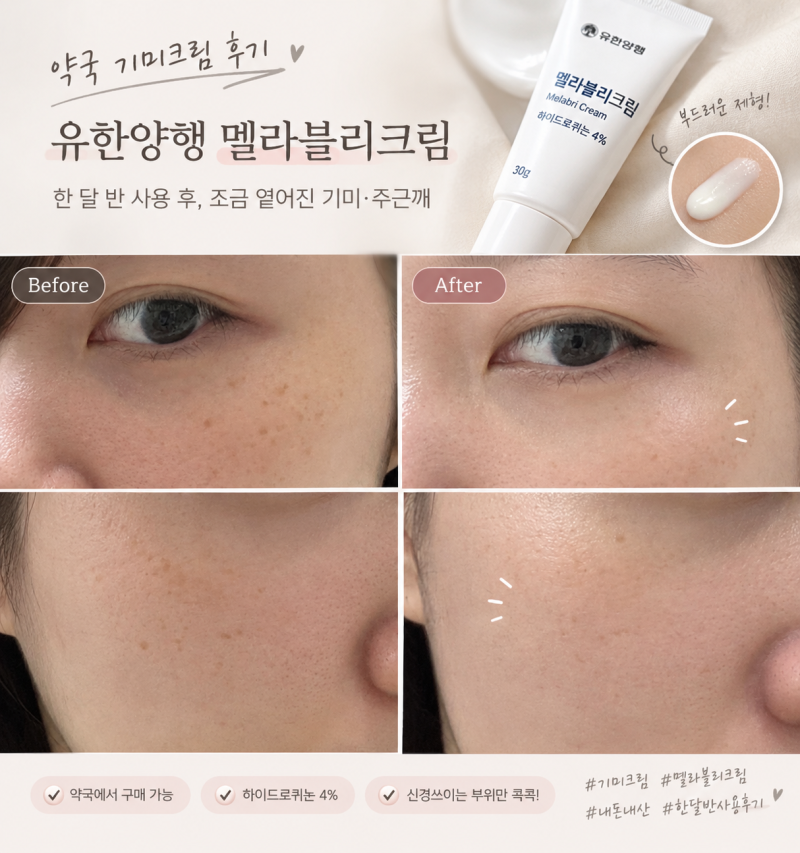 약국 기미크림 추천, 유한양행 멜라블리크림 한 달 반 사용 후기