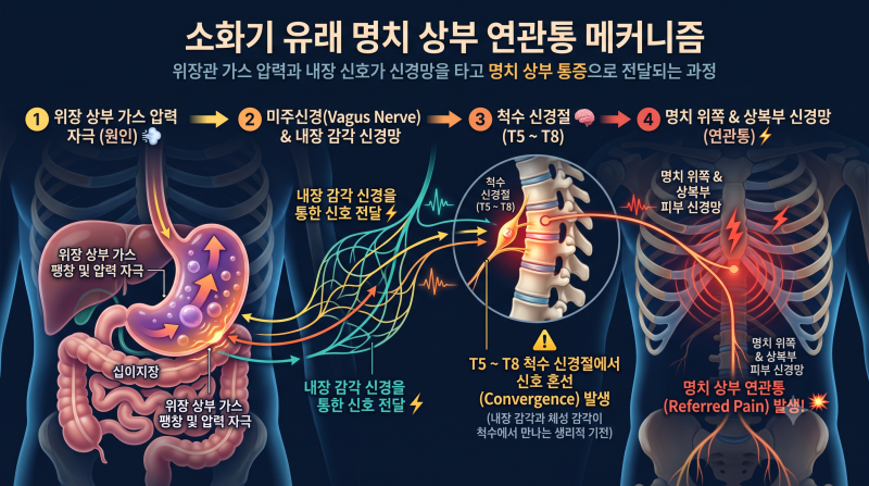 명치 상복부가 뻐근하고 답답한 원인. 내시경 초음파 CT는 정상인데 이유가 뭘까?