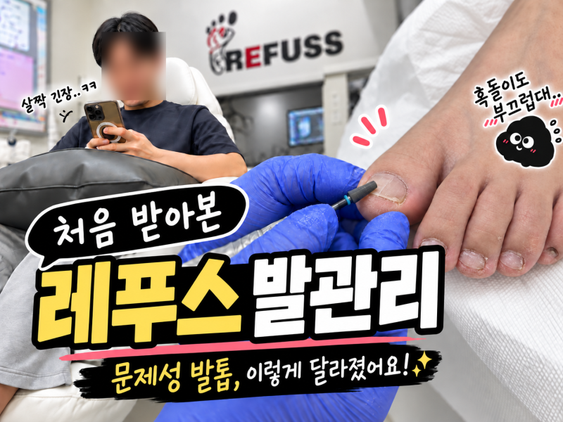 아산 발톱무좀 천안 발톱무좀 관리, 레푸스 아산탕정점 두꺼운 발톱 후기