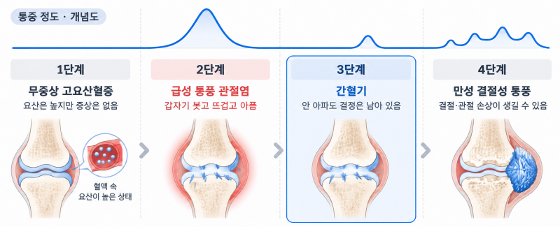 통풍 약, 평생 먹어야 하나요? 통풍의 4단계 분류와 단계별 치료