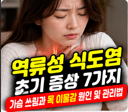 역류성 식도염 초기 증상 7가지, 가슴 쓰림과 목 이물감 원인 및 관리법