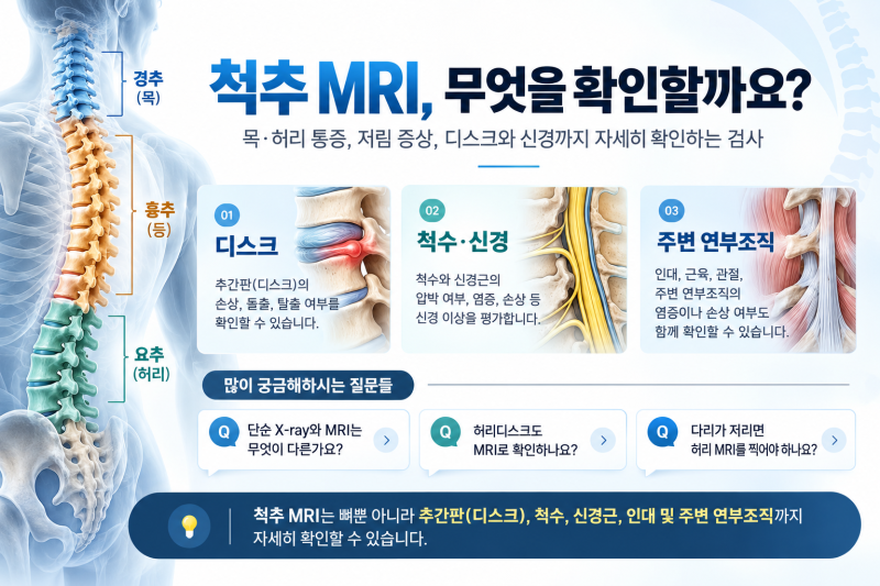 목·허리 통증, 척추 MRI는 무엇을 확인할까요?｜경추·흉추·요추 MRI 검사 안내(주말·공휴일 ....