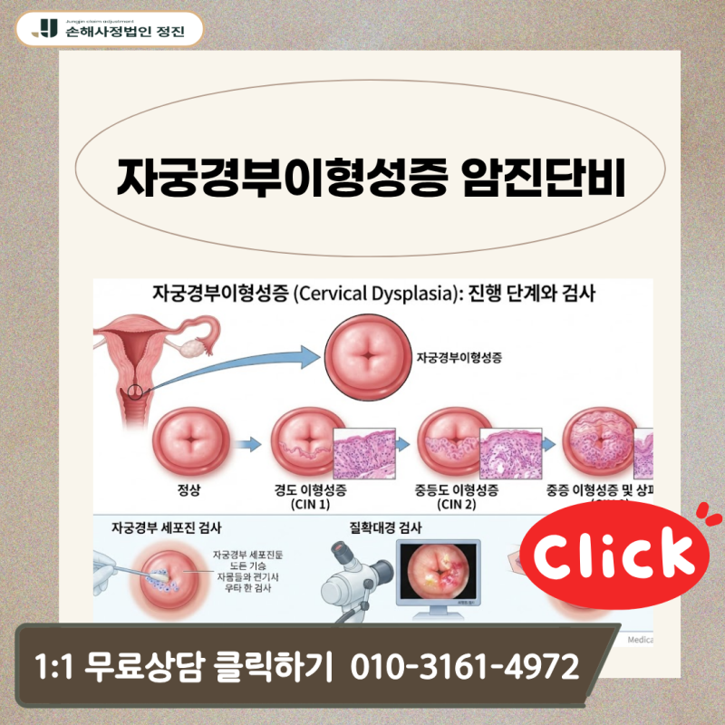 자궁경부이형성증 암진단비, N87.1 코드 받아도 D06 제자리암 보상 가능할까?