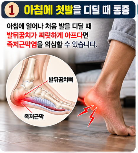 아침에 첫발 디딜 때 발뒤꿈치 통증 원인, 족저근막염 스트레칭 방법 총정리