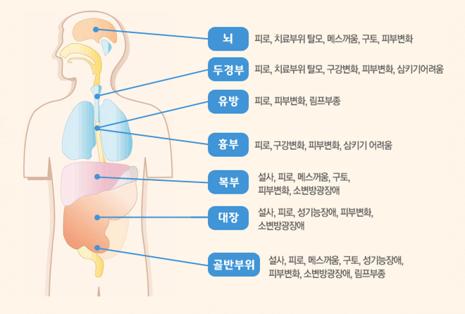 암 치 료