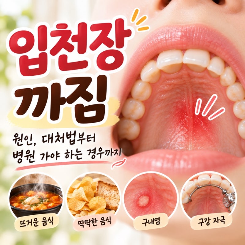 입천장까짐 원인과 대처법, 껍질 벗겨짐과 통증 관리 방법