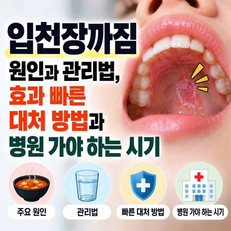 입천장까짐 원인과 관리법, 효과 빠른 대처 방법과 병원 가야 하는 시기