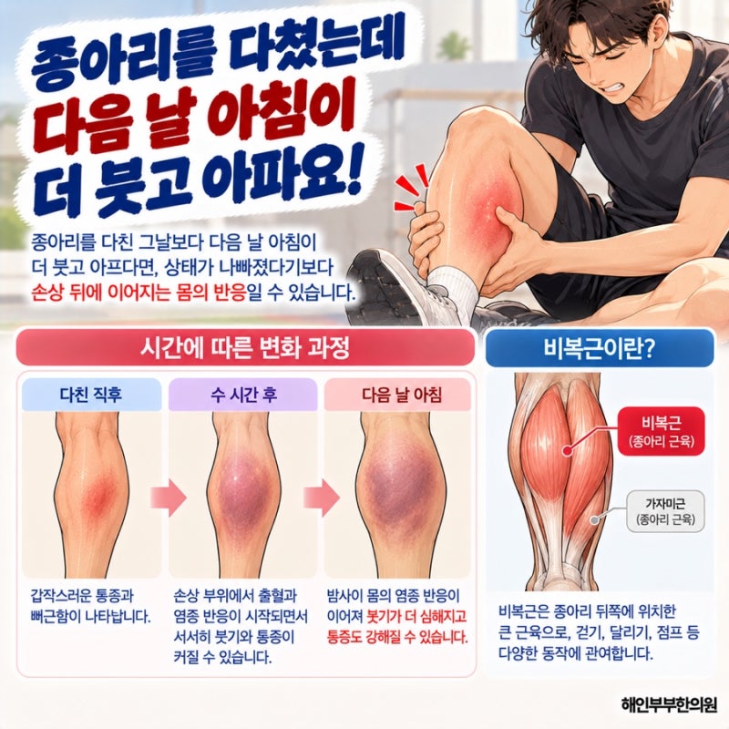 다친 다음 날 더 붓는 이유, 수원 비복근손상 3일의 변화
