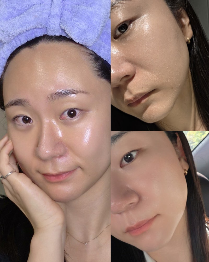 수부지 피부 완전 정복 가이드 - 3년 동안 직접 찾아낸 루틴과 성분 총정리