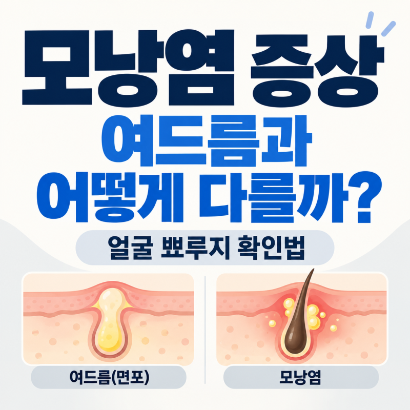 모낭염 증상, 여드름과 어떻게 구별할까? 얼굴 뾰루지 확인법