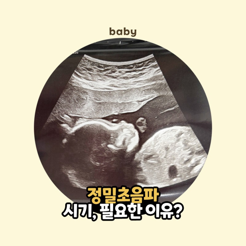 정밀초음파 시기 이유는? 평택 라움산부인과 20주 정밀초음파 후기