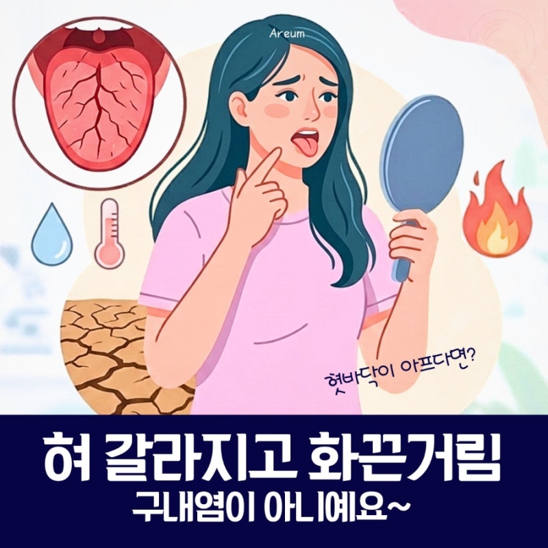 혀가 쩍쩍 갈라지고 화끈거릴 때, 단순 구내염이 아니라고요? (소화 효소와 3가지 원인)