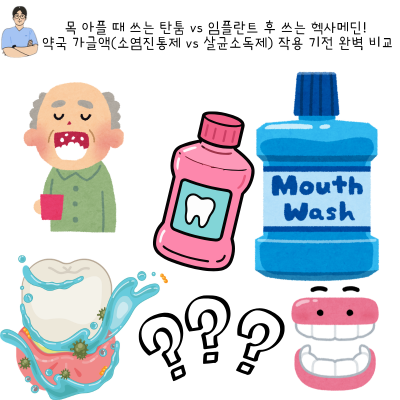 목 아플 때 쓰는 탄툼 vs 임플란트 후 쓰는 헥사메딘! 약국 가글액(소염진통제 vs 살균소독제) ....