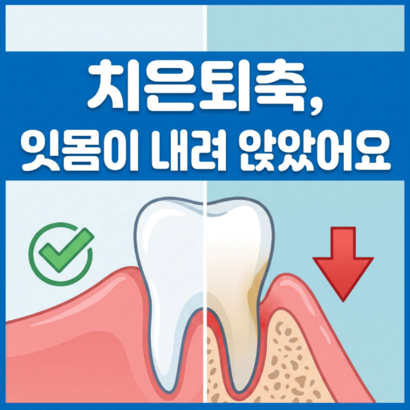 잇몸 내려앉음 치료 방법, 잇몸 영양제 효과 있나요?