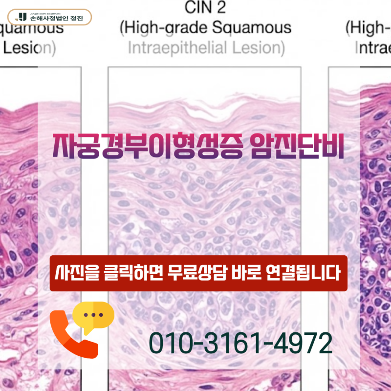 자궁경부이형성증 암진단비, N87.1 진단 후 D06 제자리암으로 인정받는 비결은?