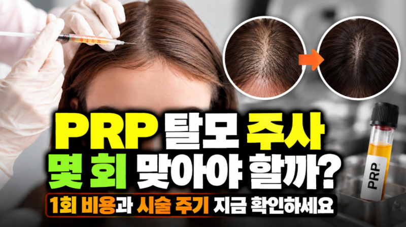 PRP 탈모 주사 몇 회 맞아야 할까? 1회 비용과 시술 주기 지금 확인하세요