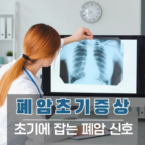 폐암 초기증상, 기침부터 어깨·등 통증까지 그리고 초기 완치율 정리