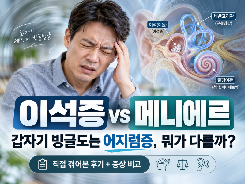 이석증과 메니에르병 차이｜7~8년 전 메니에르, 최근 이석증까지 직접 겪은 후기·증상·후유....