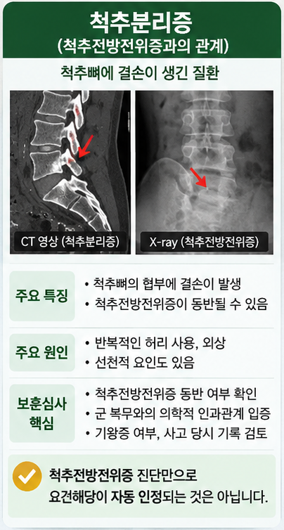 군대 허리질환 국가유공자 등록, 허리디스크·척추분리증·강직성척추염은 심사기준이 다릅....