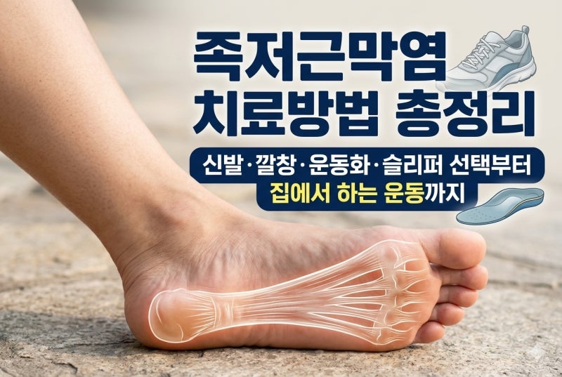 “족저근막염 치료방법 총정리” 신발·깔창·운동화·슬리퍼 선택부터 집에서 하는 운동까....