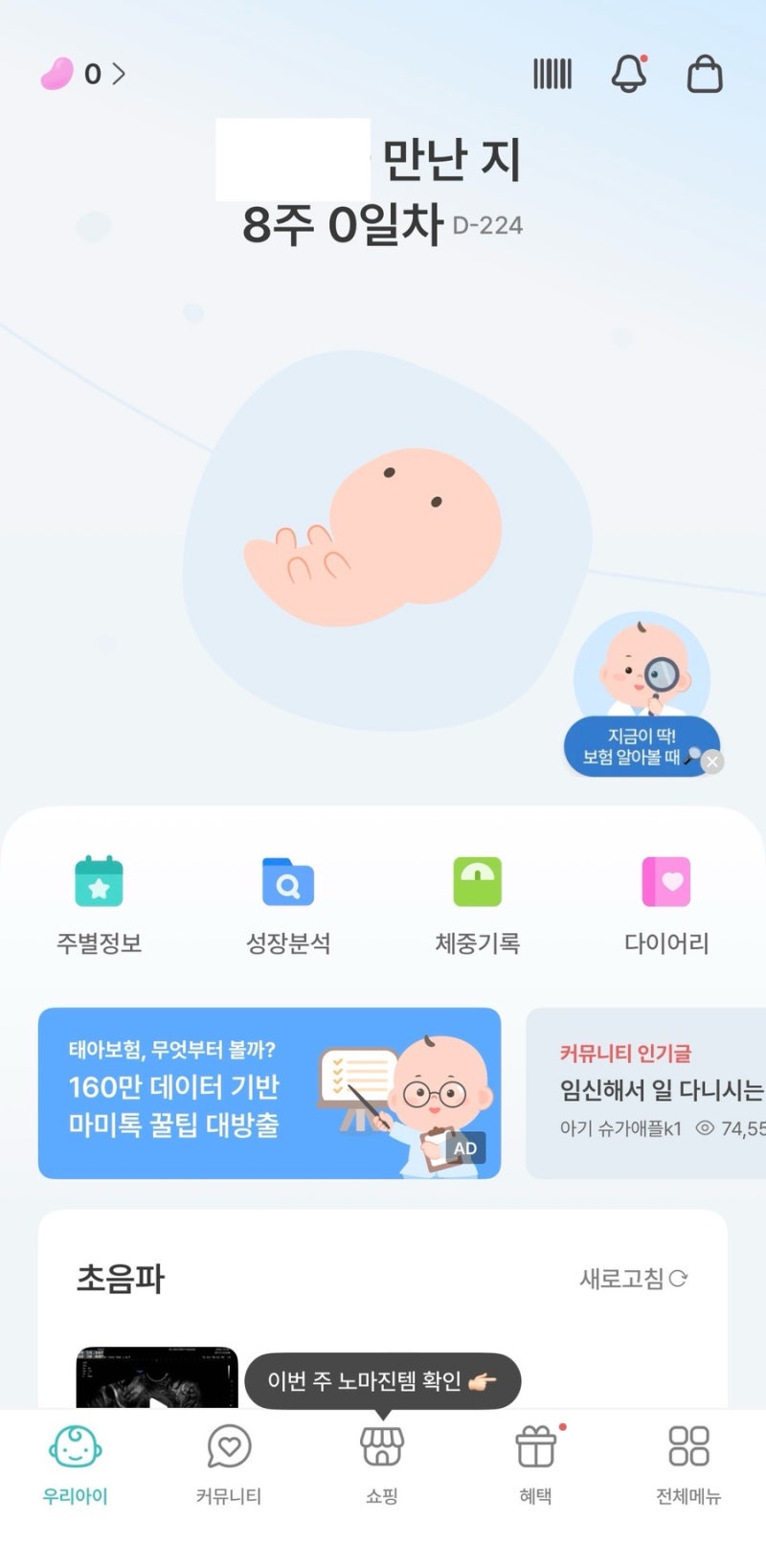 7주차 계류유산 진단 8주차 소파술 당일 후기 (feat 통증 소요시간 비용 다음 임신 준비 등)