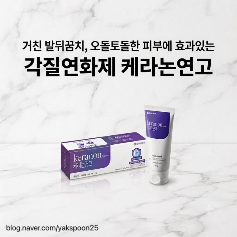 케라논 연고 : 거친 발뒤꿈치, 오돌토돌한 피부에 효과적인 각질연화제