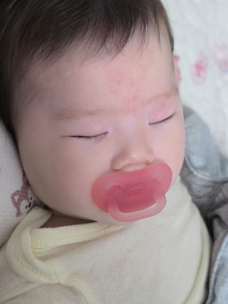 아기 두상베개 니노필로우 최종후기｜신생아 사두 고민부터 6개월 두상 변화까지
