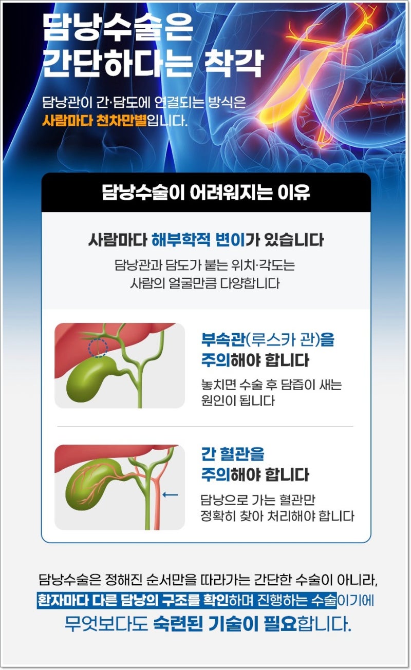 위내시경은 정상인데 명치와 오른쪽 윗배가 자꾸 아프다면? 담석 여부부터 확인해보세요