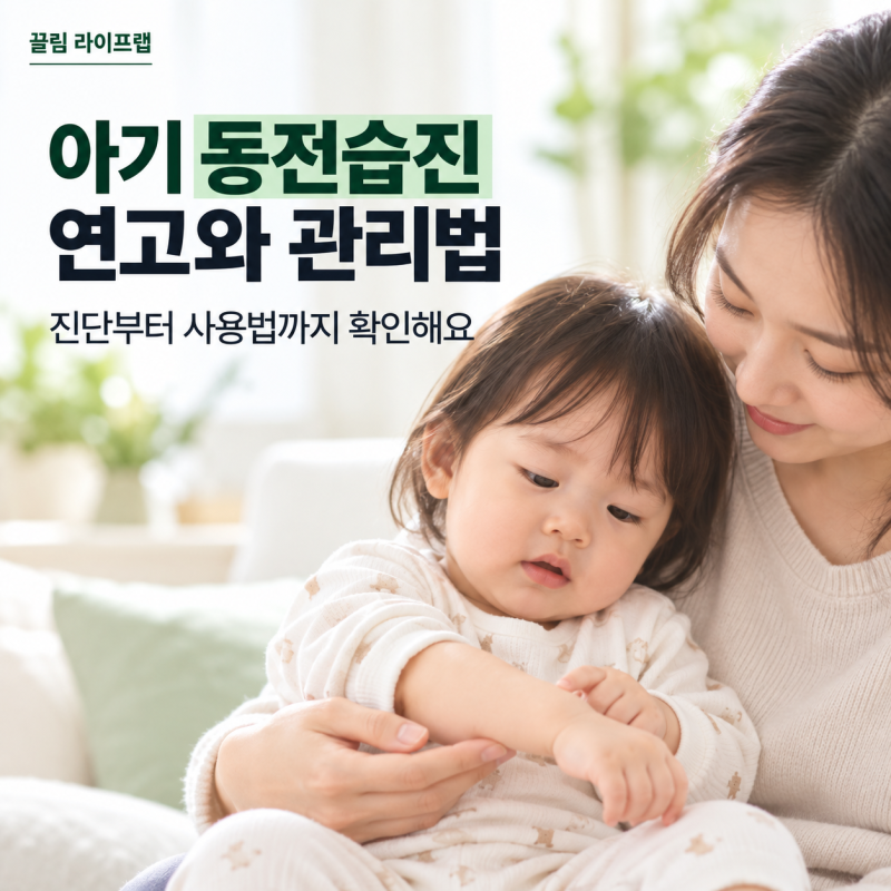 아기 동전습진 연고 종류와 관리법, 유아 습진에 주의할 점