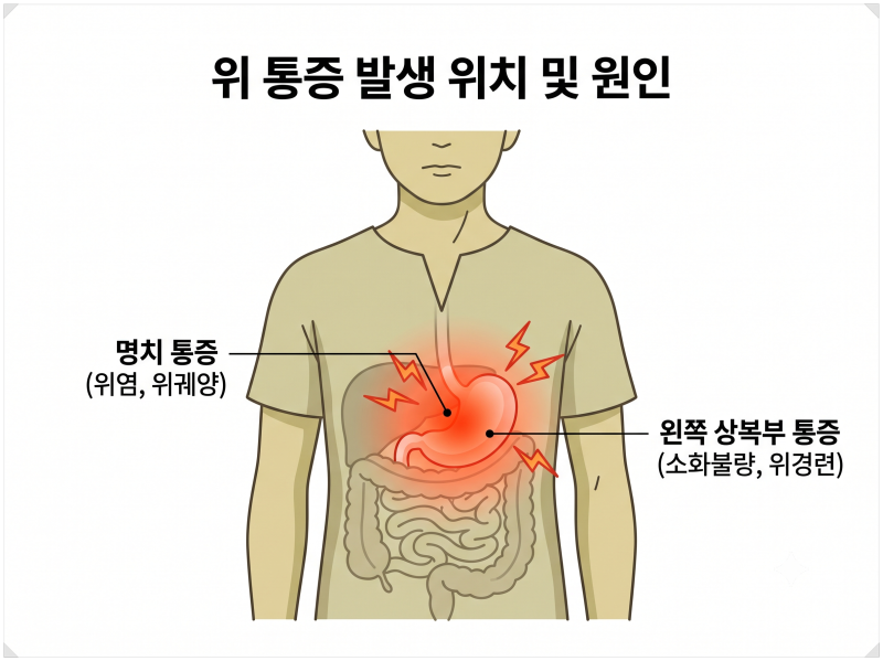 위 통증 원인별 위치와 처방전 필요없는 약국 약 총정리
