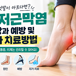[용현동 헬스장 왕삼두짐] 족저근막염 증상과 예방 및 자가 치료방법
